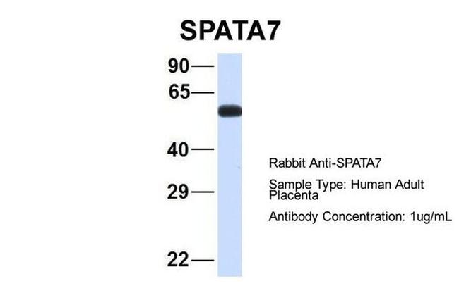 SPATA7 Antibody in Western Blot (WB)