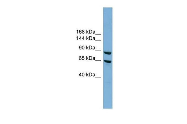 EXOC6 Antibody in Western Blot (WB)