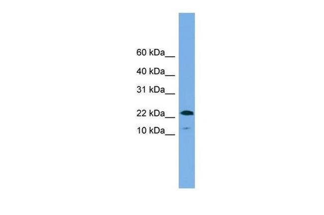 WFDC1 Antibody in Western Blot (WB)