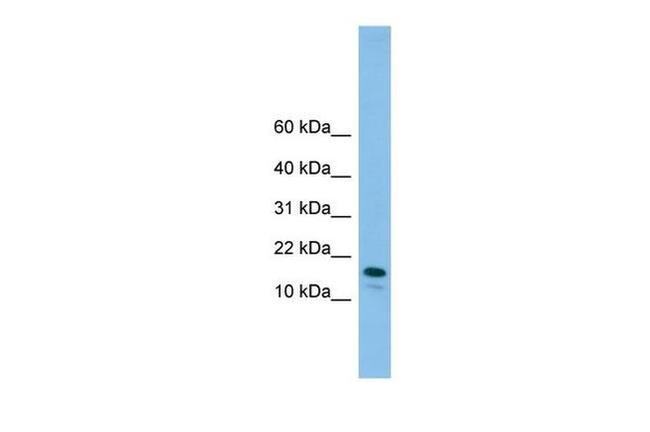 GREM2 Antibody in Western Blot (WB)