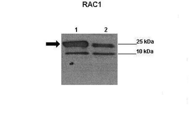 RAC1 Antibody (PA5-44839)