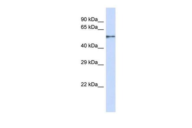 ZNF44 Antibody in Western Blot (WB)