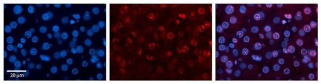 RUNX1T1 Antibody in Immunohistochemistry (Paraffin) (IHC (P))