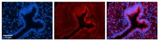 PHLDA2 Antibody in Immunohistochemistry (Paraffin) (IHC (P))