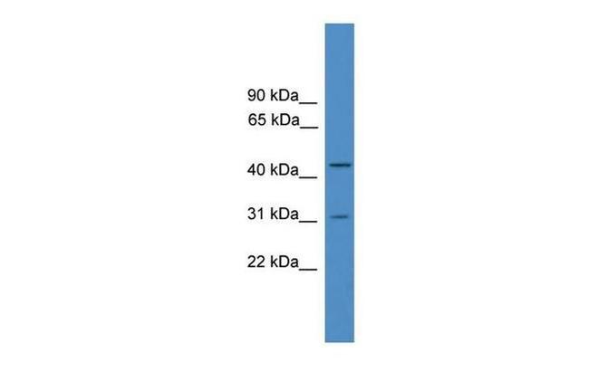 OTUD6A Antibody in Western Blot (WB)
