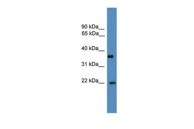 COPS6 Antibody in Western Blot (WB)