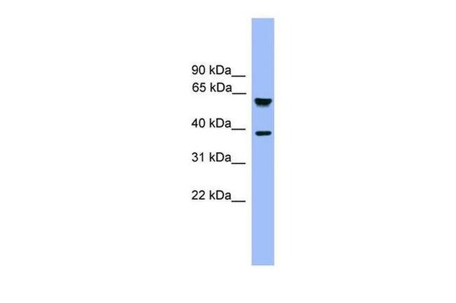 FBXL12 Antibody in Western Blot (WB)
