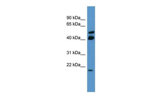 RERG Antibody in Western Blot (WB)