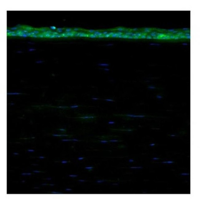 ALDH3A1 Antibody in Immunohistochemistry (IHC)