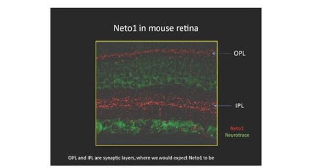 NETO1 Antibody in Immunohistochemistry (IHC)