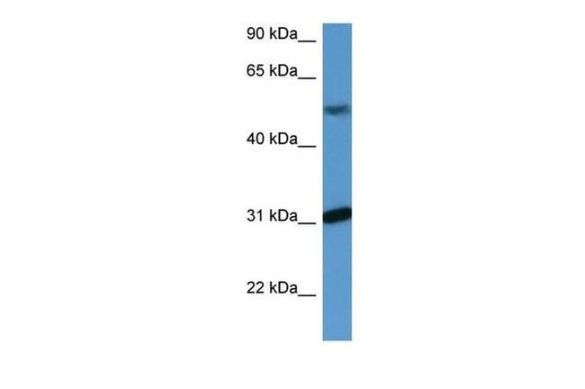 WDR83 Antibody in Western Blot (WB)