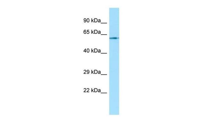 CHRM1 Antibody in Western Blot (WB)