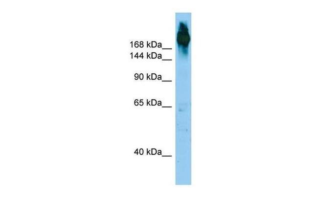 Filamin 2 Antibody in Western Blot (WB)