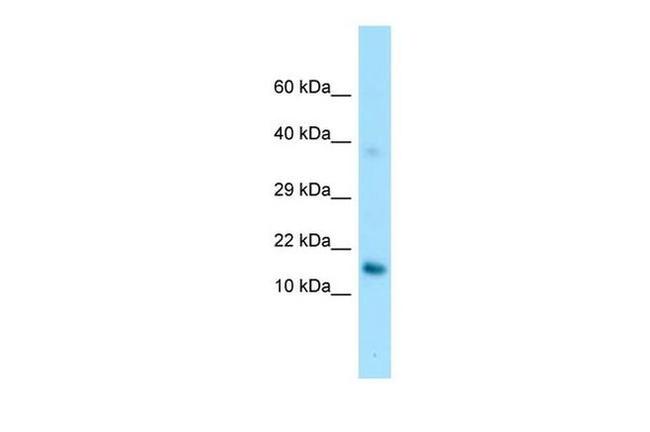 GPIHBP1 Antibody in Western Blot (WB)