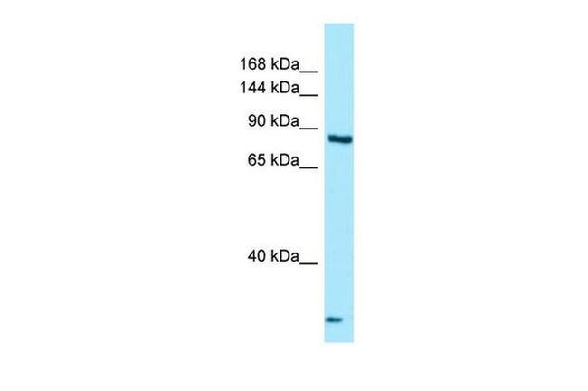 THADA Antibody in Western Blot (WB)