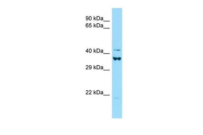 DEF6 Antibody in Western Blot (WB)