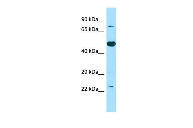 Thromboxane synthase Antibody in Western Blot (WB)