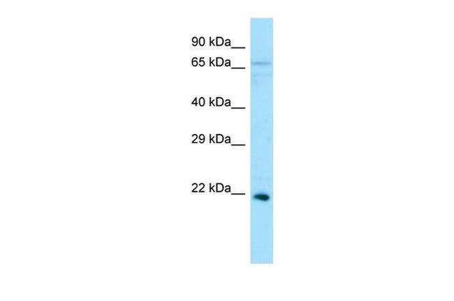 Ephrin A5 Antibody in Western Blot (WB)
