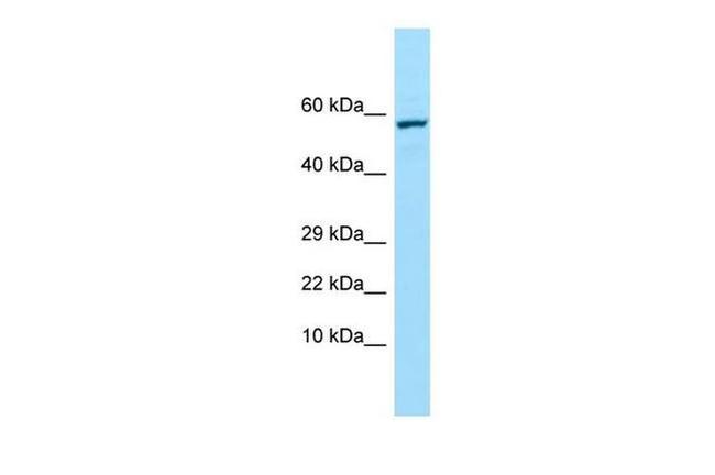 TREH Antibody in Western Blot (WB)