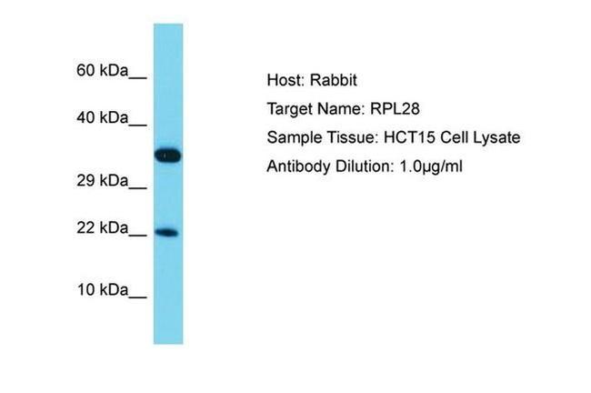 RPL28 Antibody in Western Blot (WB)