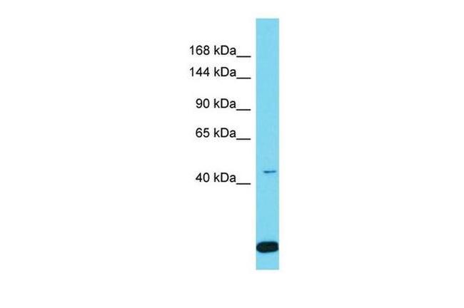SPAG1 Antibody in Western Blot (WB)