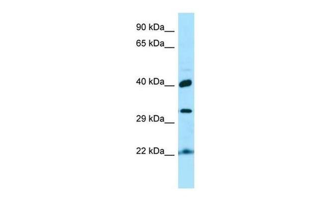 KTI12 Antibody in Western Blot (WB)