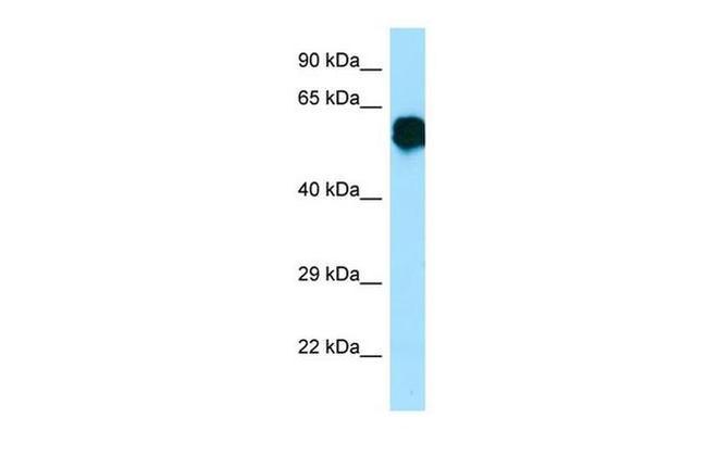 Crry Antibody in Western Blot (WB)