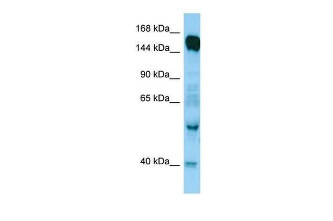 RAPGEF6 Antibody in Western Blot (WB)
