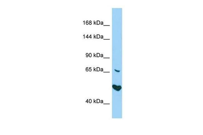 AKNA Antibody in Western Blot (WB)