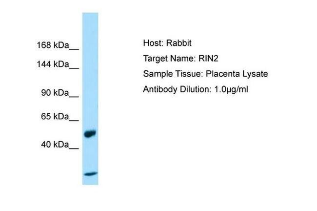 RIN2 Antibody in Western Blot (WB)