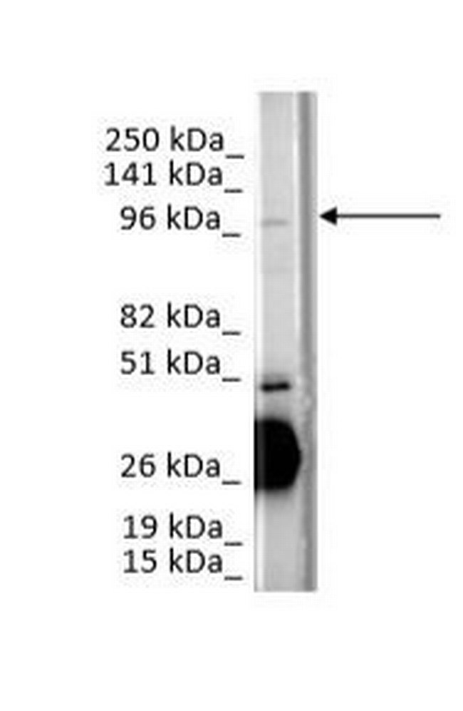 CCDC80 Antibody in Western Blot (WB)