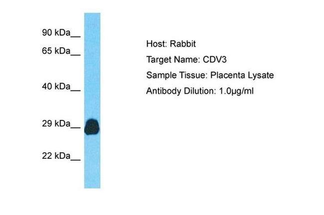 CDV3 Antibody in Western Blot (WB)