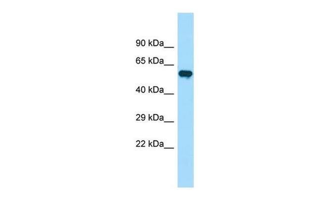 PIP5K1B Antibody in Western Blot (WB)