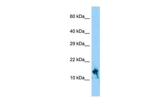 IGFL1 Antibody in Western Blot (WB)