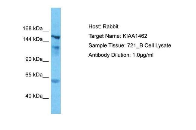KIAA1462 Antibody in Western Blot (WB)