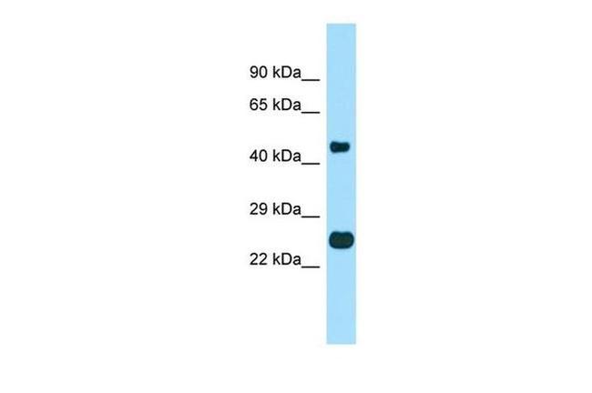 TMBIM4 Antibody in Western Blot (WB)