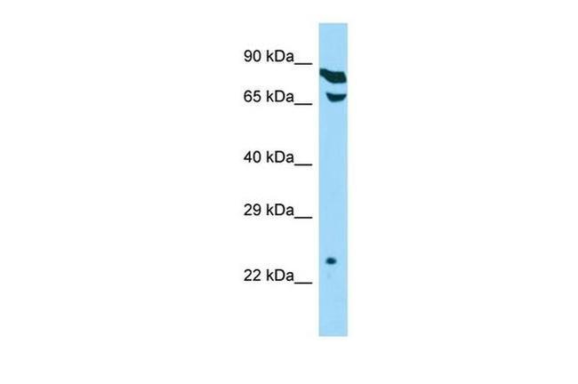 THOC7 Antibody in Western Blot (WB)