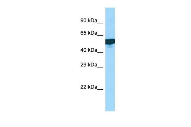 C1rLP Antibody in Western Blot (WB)