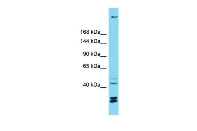 KIAA1551 Antibody in Western Blot (WB)