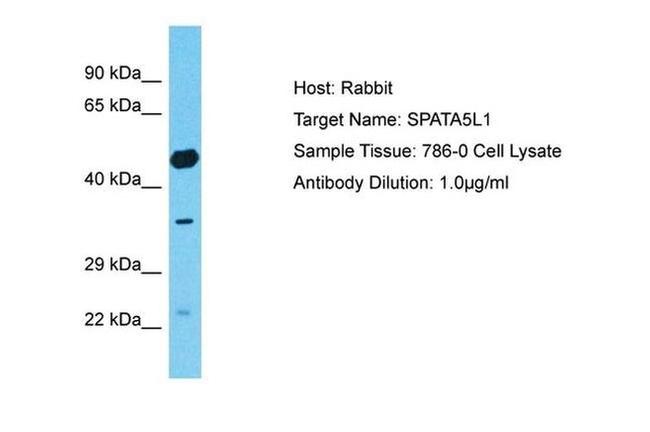 SPATA5L1 Antibody in Western Blot (WB)