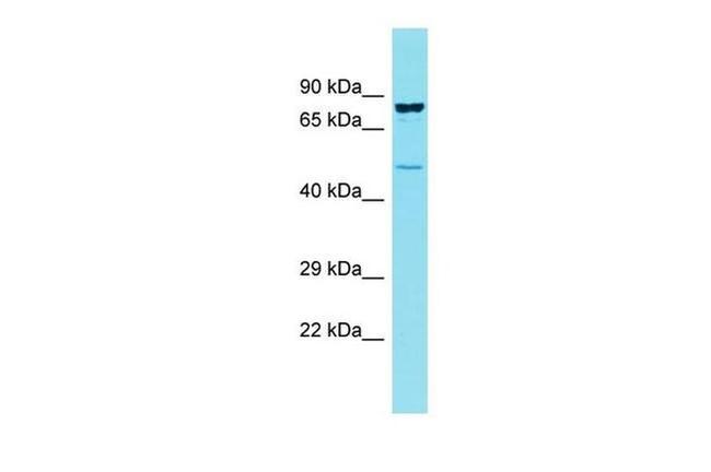 CCDC121 Antibody in Western Blot (WB)