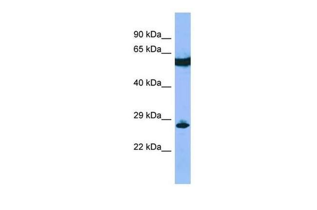 C22orf13 Antibody in Western Blot (WB)