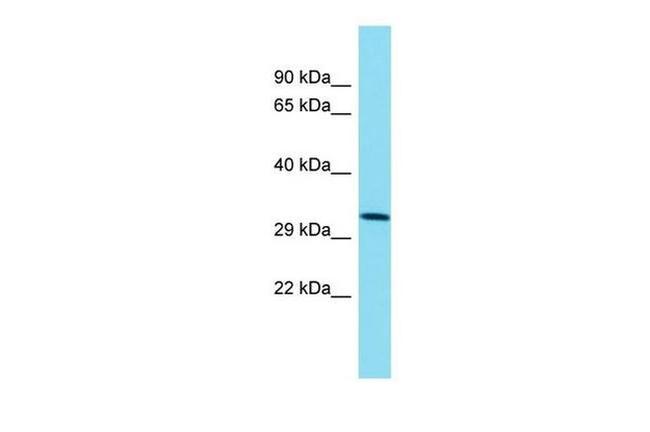 TMEM241 Antibody in Western Blot (WB)