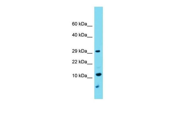 TMEM261 Antibody in Western Blot (WB)