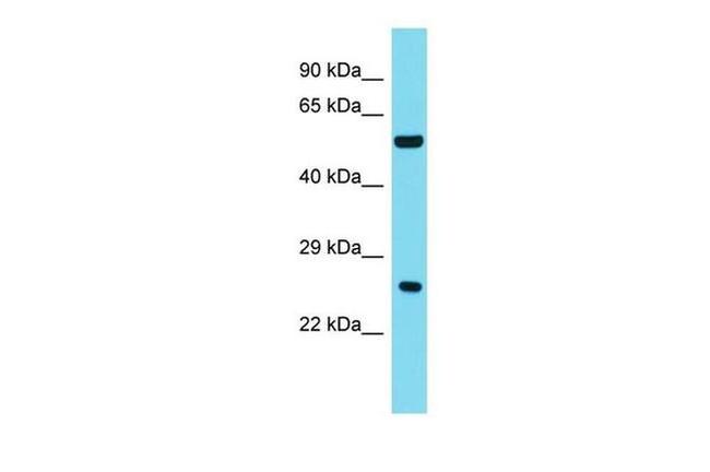 ANKRD18A Antibody in Western Blot (WB)