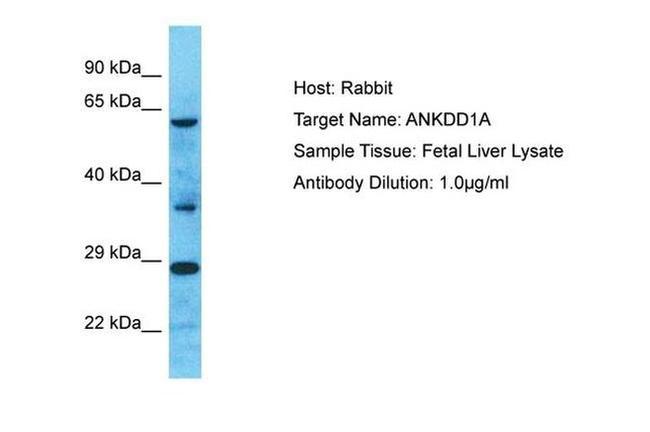 ANKDD1A Antibody in Western Blot (WB)
