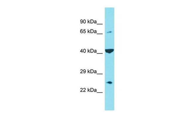 C6orf120 Antibody in Western Blot (WB)