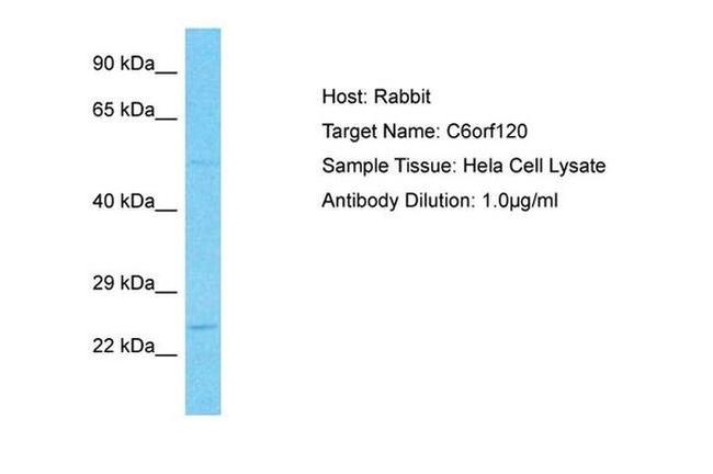 C6orf120 Antibody in Western Blot (WB)