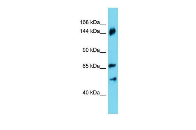 ANKRD18B Antibody in Western Blot (WB)