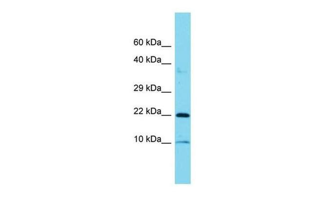 COPZ1 Antibody in Western Blot (WB)